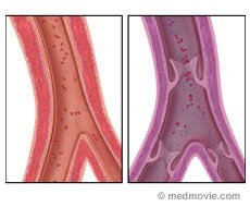 Homeopathy Medicine for Circulation Disorders